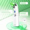 RT-8080 Blackhead Vacuum Suction Remover For women-66-01